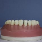 Dentes Diferenciados 172