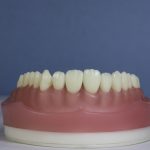 Dentes Diferenciados 173