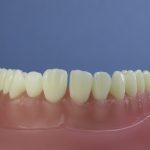 Dentes Diferenciados 119