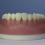 Dentes Diferenciados 174