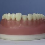 Dentes Diferenciados 175