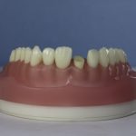 Differentiated Teeth 150