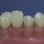 Differentiated Teeth 34