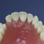 Dentes Diferenciados 116