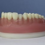 Dentes Diferenciados 170