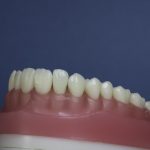 Dentes Diferenciados 169