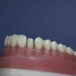 Dentes Diferenciados 168