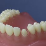 Dentes Diferenciados 111