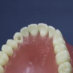 Dentes Diferenciados 109