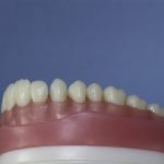 Dentes Diferenciados 166