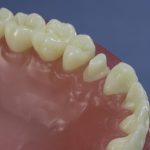 Dentes Diferenciados 105
