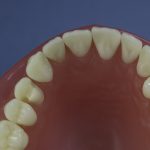 Dentes Diferenciados 104