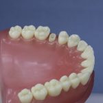 Dentes Diferenciados 149