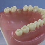 Dentes Diferenciados 142