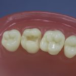 Differentiated Teeth 29