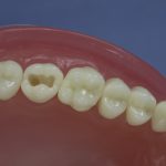 Differentiated Teeth 98