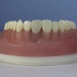 Differentiated Teeth 165