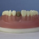 Differentiated Teeth 164