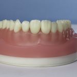 Dentes Diferenciados 163