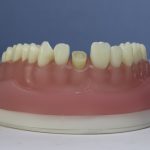 Dentes Diferenciados 151