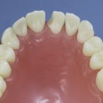 Dentes Diferenciados 96