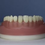Dentes Diferenciados 161