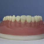 Dentes Diferenciados 91