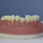 Dentes Diferenciados 90