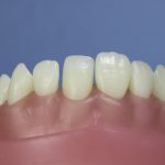 Dentes Diferenciados 89