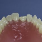 Dentes Diferenciados 81