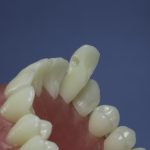 Differentiated Teeth 26