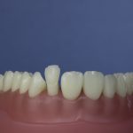 Dentes Diferenciados 73