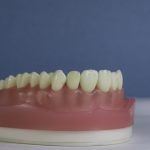 Dentes Diferenciados 160