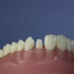 Dentes Diferenciados 77