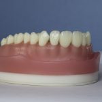 Dentes Diferenciados 158