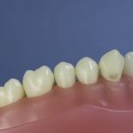 Dentes Diferenciados 69