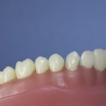 Dentes Diferenciados 71