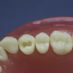 Dentes Diferenciados 24