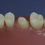 Differentiated Teeth 22