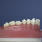 Dentes Diferenciados 123