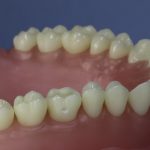 Dentes Diferenciados 60