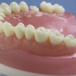 Dentes Diferenciados 186