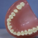 Dentes Diferenciados 185
