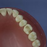 Dentes Diferenciados 59