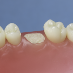 Differentiated Teeth 139