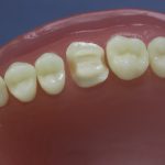 Dentes Diferenciados 58