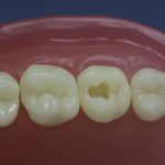 Dentes Diferenciados 21