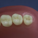Dentes Diferenciados 20