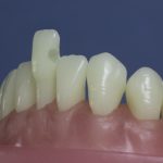 Differentiated Teeth 19