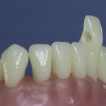 Dentes Diferenciados 18